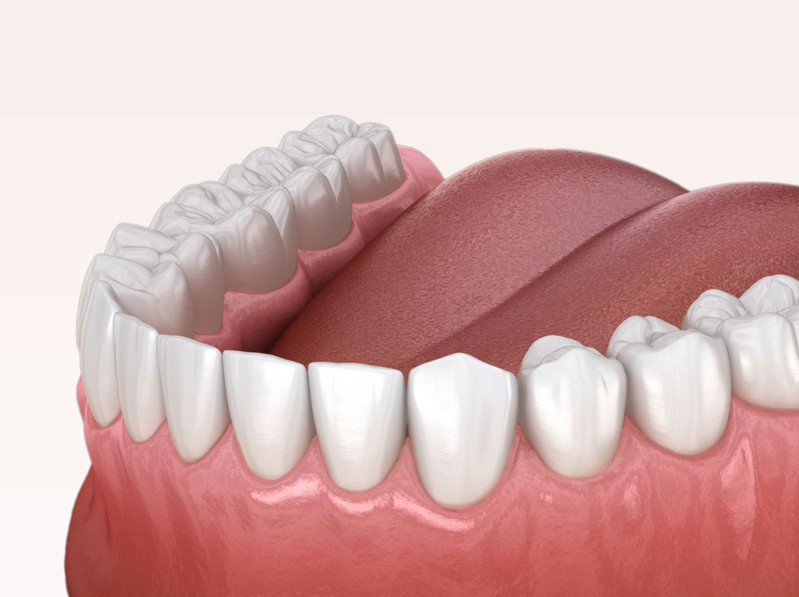 Zahnreinigung Dentalreinigung Ittingen